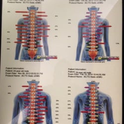 Bella Vista Family Chiropractic - Ever new patient gets an EMG Muscle scan so we can see where your spinal issues are located.