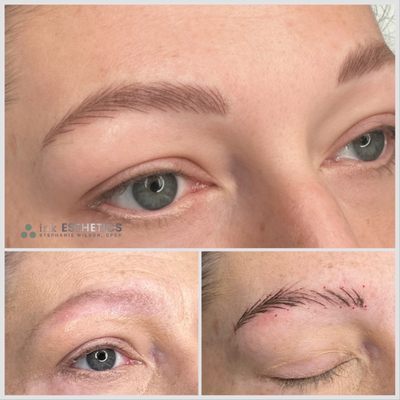Microblading for Brows - Microblading is done using a manual tool to create hairstrokes that mimic your natural brow hair. * This technique does not suit all skin type Microblading for Brows - Microblading is done using a manual tool to create hairstrokes that mimic your natural brow hair. * This technique does not suit all skin type