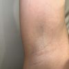 EBG Laser Hair Removal Studio gift card