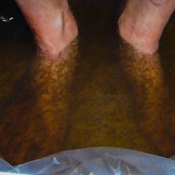 Natural Health Center - Feel more energetic by getting toxins out. We offer detox foot baths. Thus is the result of the detox.