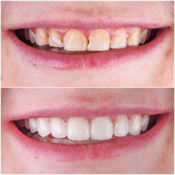 Dani Benyaminy, DDS