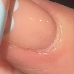 Hair under top coat Hair under top coat