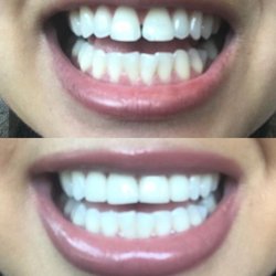 DentalWorks