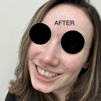 Beverly Hills Plastic Surgery Group - Front view after - Cosmetic Surgeons Near Me - Beverly Hills, California