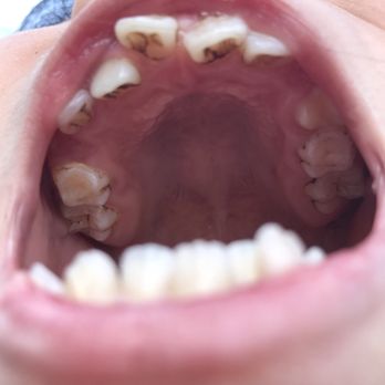 Oakland Ct Dental - General Dentistry Near Me - Oakland, California Oakland Ct Dental - General Dentistry Near Me - Oakland, California