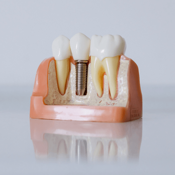 Clairemont Dentistry - Oral Surgeons Near Me - San Diego, California Clairemont Dentistry - Oral Surgeons Near Me - San Diego, California