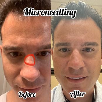 Bellissimo You - Scars ? Let us help. "Bellissimo You (813)766-0119 - Skin Care Near Me - Tampa, Florida Bellissimo You - Scars ? Let us help. "Bellissimo You (813)766-0119 - Skin Care Near Me - Tampa, Florida