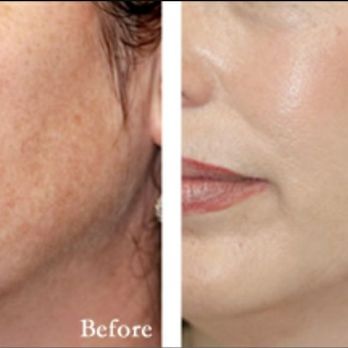 Beautique Day Spa - Diamond Microderm Treatments - Day Spas Near Me - Fort Worth, Texas Beautique Day Spa - Diamond Microderm Treatments - Day Spas Near Me - Fort Worth, Texas