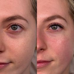Lavish Lashes Club - Classic set before and after