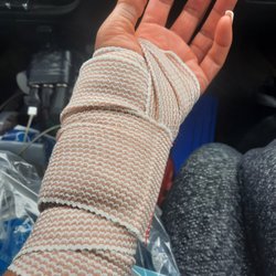 Pacific Urgent Care - Finally one source of pain removed due to your referral, 2yr old ganglion cyst gone!