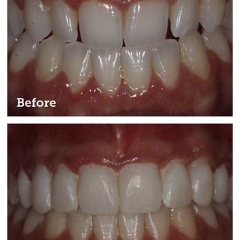 VIKARA - Orthodontists Near Me - Miami, Florida