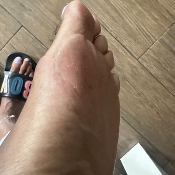 Millennial Nails - After pedicure - Nail Salons Near Me - Brooklyn, New York