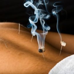 Blue Ridge Acupuncture & Integrative Health - Heat Therapy