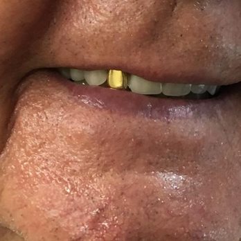 Artemisa Dental Lab - Prosthodontists Near Me - Miami, Florida Artemisa Dental Lab - Prosthodontists Near Me - Miami, Florida