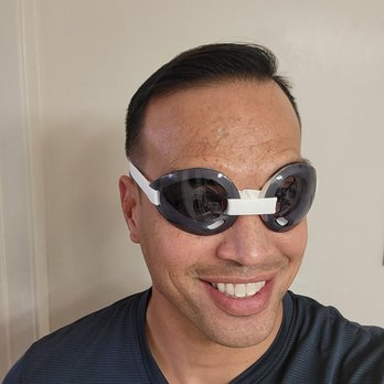 LA Sight - Day after lasik surgery by Dr. Wallace at LA sight. Goggles included. - Ophthalmologists Near Me - Los Angeles, California LA Sight - Day after lasik surgery by Dr. Wallace at LA sight. Goggles included. - Ophthalmologists Near Me - Los Angeles, California