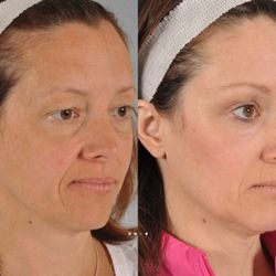W Cosmetic Surgery - W Cosmetic Surgery