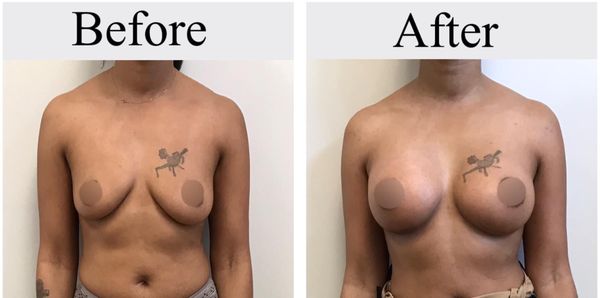 Orland Park Plastic Surgery