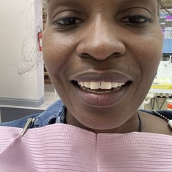 Dr. Joseph O'Connor & Dr. Claudia O'Connor D.D.S. - My 2 front teeth are rounded up.