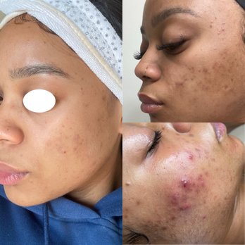 Nika Aesthetics - Skin Care Near Me - Los Angeles, California Nika Aesthetics - Skin Care Near Me - Los Angeles, California