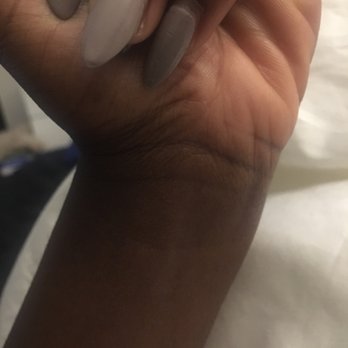Glitz Nail - Two weeks after I got it done. Like the shape which Kevin did for me - Waxing Near Me - New York, New York