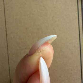 Perfect 10 Nail Spa - I got nicked from the rough filing - Skin Care Near Me - San Jose, California