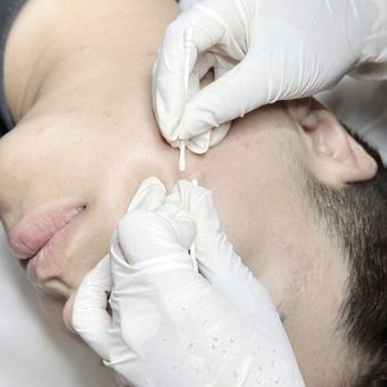 Energy Wellness - Skin Care Near Me - Westminster, California Energy Wellness - Skin Care Near Me - Westminster, California