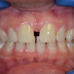 Jacob Shrayman, DDS - Before