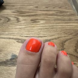 My big toenails are so messed up!