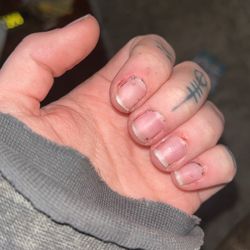Le Nails - Bloody cuticles and cut jagged