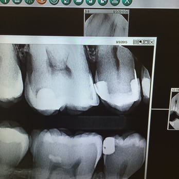 Oak Grove Dental - General Dentistry Near Me - Concord, California Oak Grove Dental - General Dentistry Near Me - Concord, California