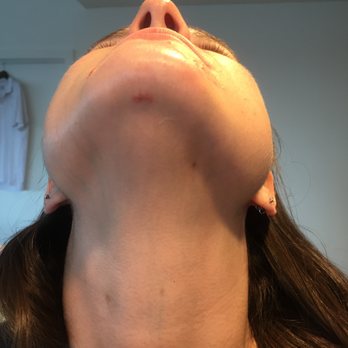 Kopelman Aesthetic Surgery - After - Cosmetic Surgeons Near Me - Paramus, New Jersey Kopelman Aesthetic Surgery - After - Cosmetic Surgeons Near Me - Paramus, New Jersey