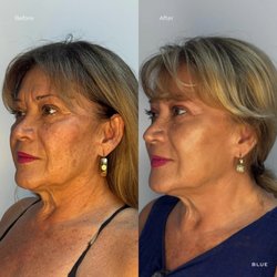 Blue Medi Spa