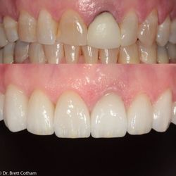 Brett E Cotham DDS - All About Smiles - Cosmetic Smile Design by Dr. Brett Cotham.