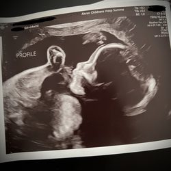 Pinnacle Fertility - Akron