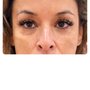 Blink Wink Lash