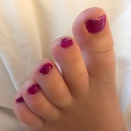 Taken three hours after pedicure Taken three hours after pedicure