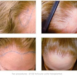 Miami Hair Institute - Specializing in natural results for women.