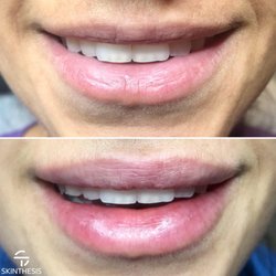 Skin worship reviews picture