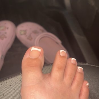U2 Nail Studio - Comparison of my right to left toe - Nail Salons Near Me - Chicago Ridge, Illinois U2 Nail Studio - Comparison of my right to left toe - Nail Salons Near Me - Chicago Ridge, Illinois
