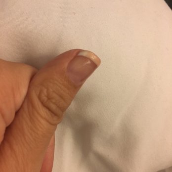 Ballantyne Nail Spa - Browned/yellowed so quickly - Nail Salons Near Me - Charlotte, North Carolina Ballantyne Nail Spa - Browned/yellowed so quickly - Nail Salons Near Me - Charlotte, North Carolina