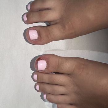 Nail Studio - Possible infection - Nail Salons Near Me - Fontana, California Nail Studio - Possible infection - Nail Salons Near Me - Fontana, California