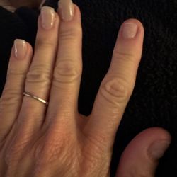 Elite Nails - 2 broken nails, with a third lifting.