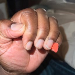 Finger with one remaining nail. Finger with one remaining nail.