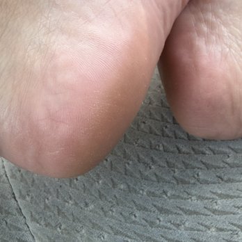 KC Nails & Spa - Didn't even removed the callus - Nail Salons Near Me - Riverside, California KC Nails & Spa - Didn't even removed the callus - Nail Salons Near Me - Riverside, California