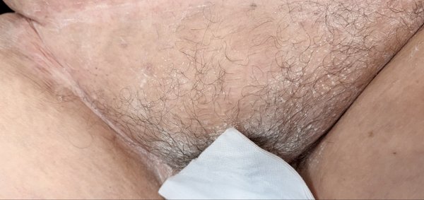 Being smoother, less maintenance, less hair growth - Brazilians is a professional and soothing intimate waxing service designed to leave you feeling smooth and confident. I use gentle techniques and premium products, ensuring comfort and care throughout the process. Embrace your confidence with a touch of Brazilian elegance. Being smoother, less maintenance, less hair growth - Brazilians is a professional and soothing intimate waxing service designed to leave you feeling smooth and confident. I use gentle techniques and premium products, ensuring comfort and care throughout the process. Embrace your confidence with a touch of Brazilian elegance.