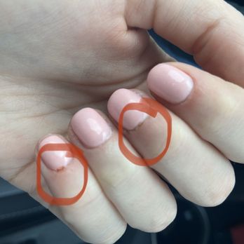 Wexford Nails & Spa - Broken, bloody cuticles - Nail Salons Near Me - Wexford, Pennsylvania Wexford Nails & Spa - Broken, bloody cuticles - Nail Salons Near Me - Wexford, Pennsylvania
