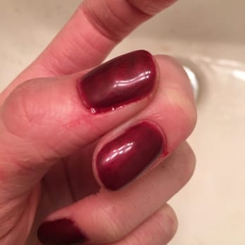 Today's Nails - Really painful bleeding cuticles :( - Nail Salons Near Me - Anchorage, Alaska