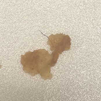 Wings and Seafood - Piece of hair found in fried fish. Right under the skin. Must have fallen into the fish batter. - Chicken Wings Near Me - Sandy Springs, Georgia Wings and Seafood - Piece of hair found in fried fish. Right under the skin. Must have fallen into the fish batter. - Chicken Wings Near Me - Sandy Springs, Georgia