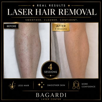 Bagardi Laser Center - Laser Hair Removal Near Me - Brighton, Massachusetts Bagardi Laser Center - Laser Hair Removal Near Me - Brighton, Massachusetts