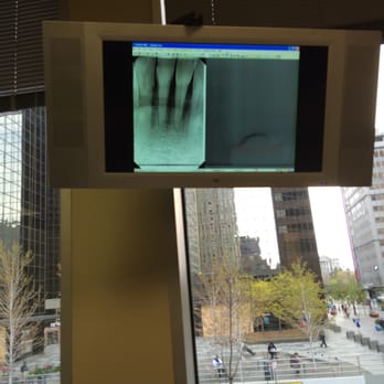 Barotz Dental - Xray with a view - Cosmetic Dentists Near Me - Denver, Colorado